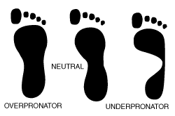 Flat Footed or Pronated